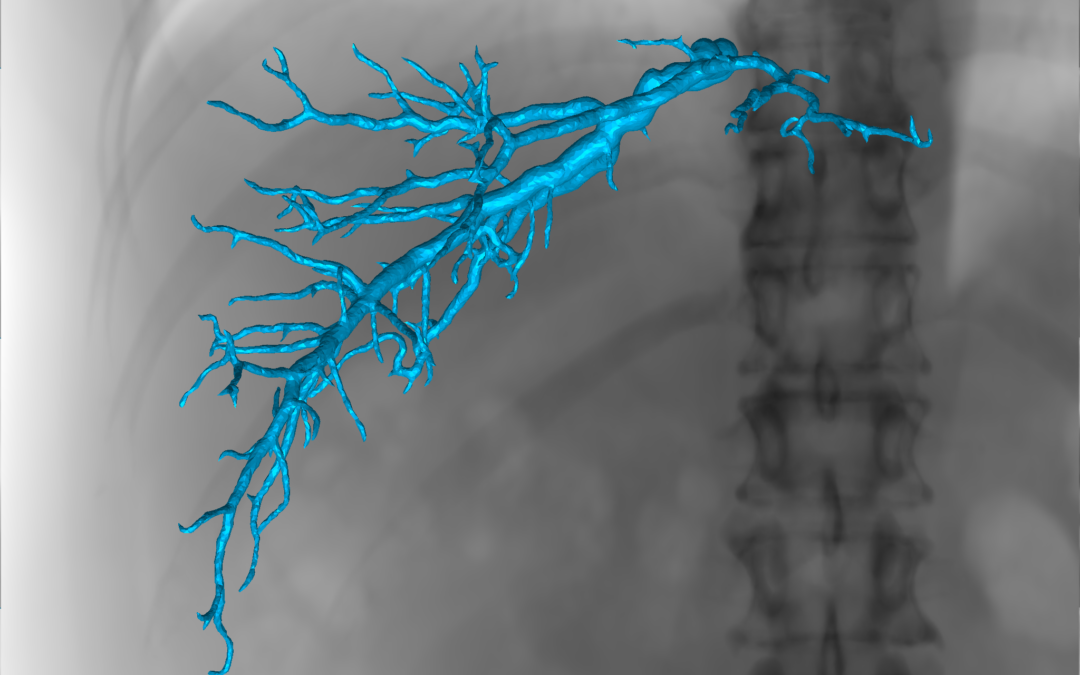 Augmented Fluoroscopy